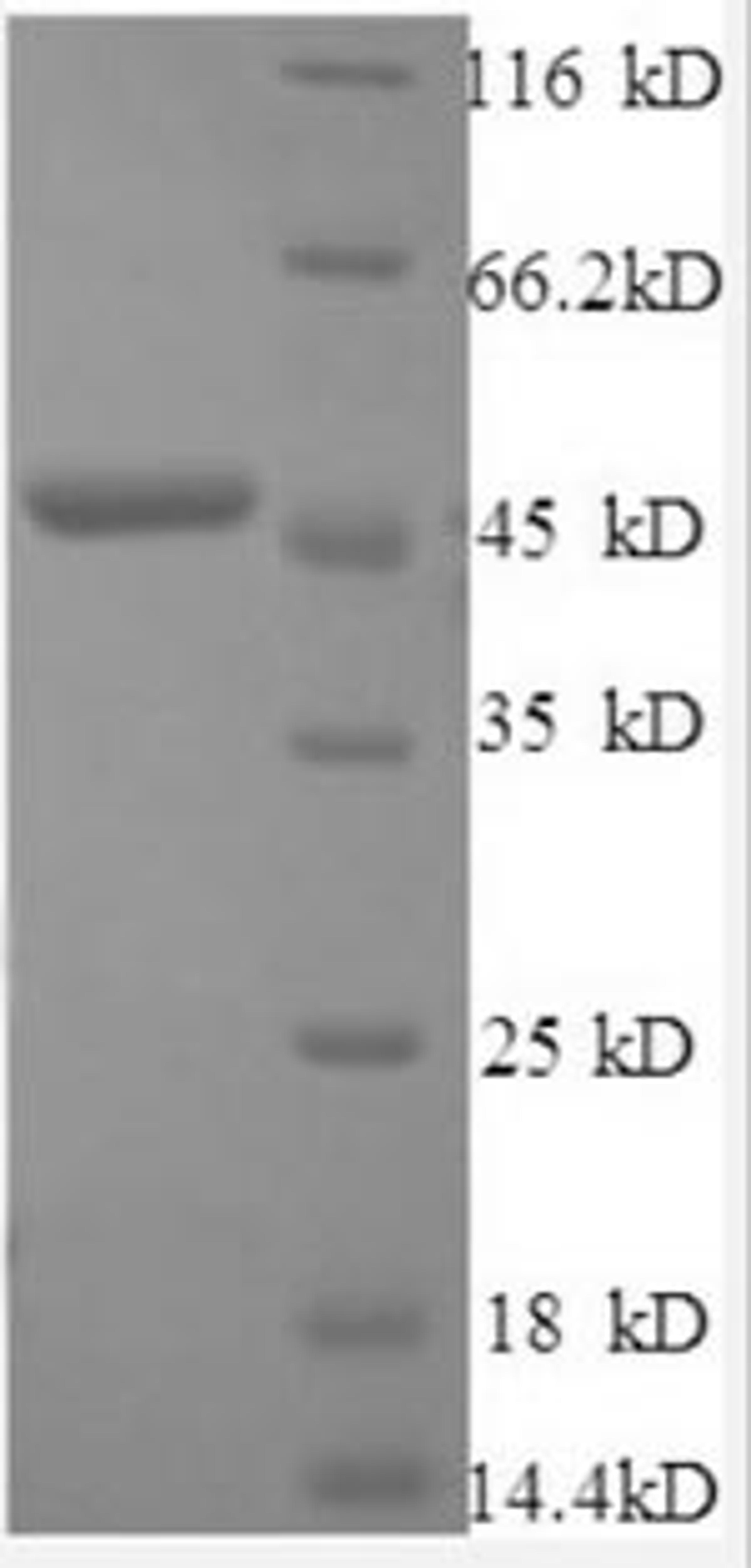(Tris-Glycine gel) Discontinuous SDS-PAGE (reduced) with 5% enrichment gel and 15% separation gel.