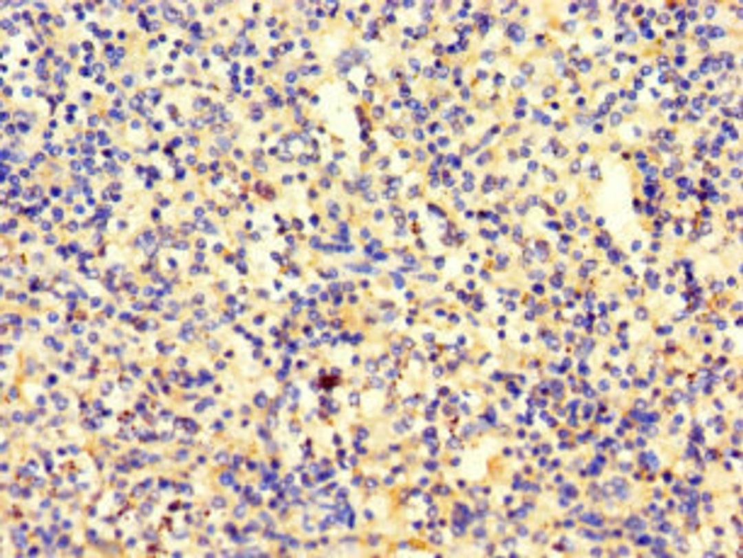 Immunohistochemistry of paraffin-embedded human spleen tissue using CSB-PA022674LA01HU at dilution of 1:100