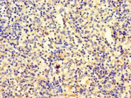 Immunohistochemistry of paraffin-embedded human spleen tissue using CSB-PA022674LA01HU at dilution of 1:100
