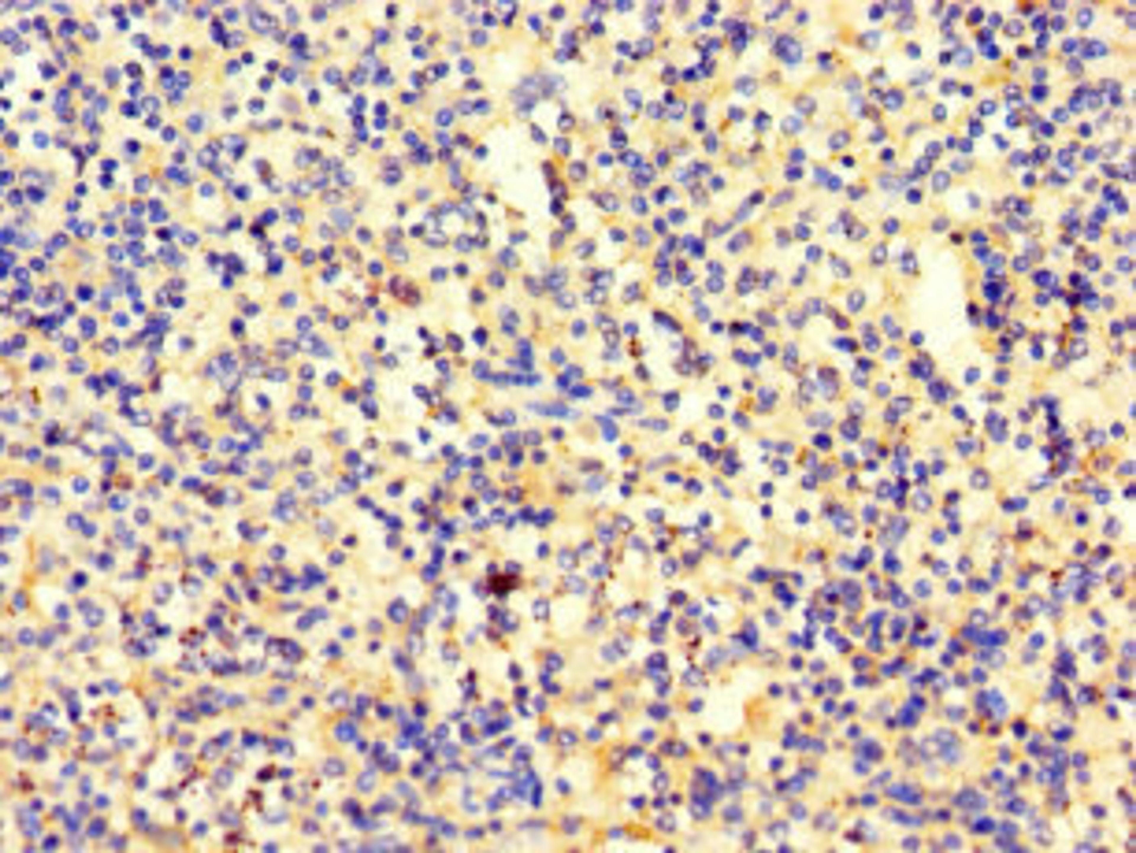 Immunohistochemistry of paraffin-embedded human spleen tissue using CSB-PA022674LA01HU at dilution of 1:100