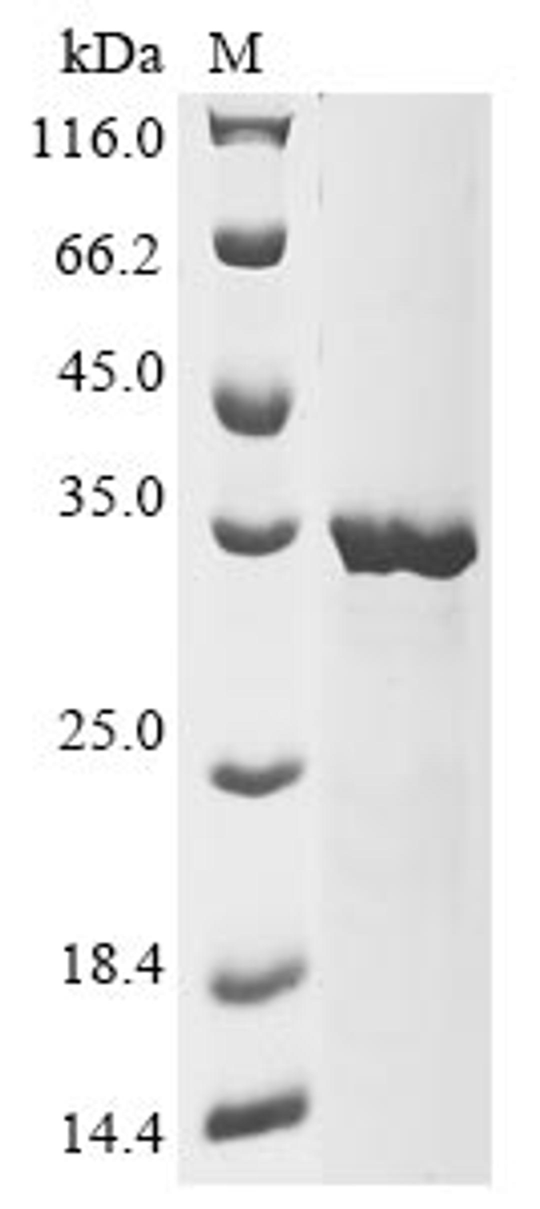 (Tris-Glycine gel) Discontinuous SDS-PAGE (reduced) with 5% enrichment gel and 15% separation gel.