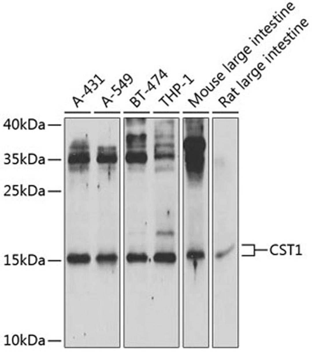 Western blot - CST1 Antibody (A6570)