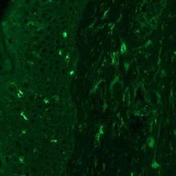 Immunocytochemistry/ Immunofluorescence: Angiopoietin-2 Antibody (MM0020-1F29) [NB110-85467] - Staining of frozen human skin sections using Angiopoietin 2 antibody at 1:25 dilution. Image provided via product review by verified customer.