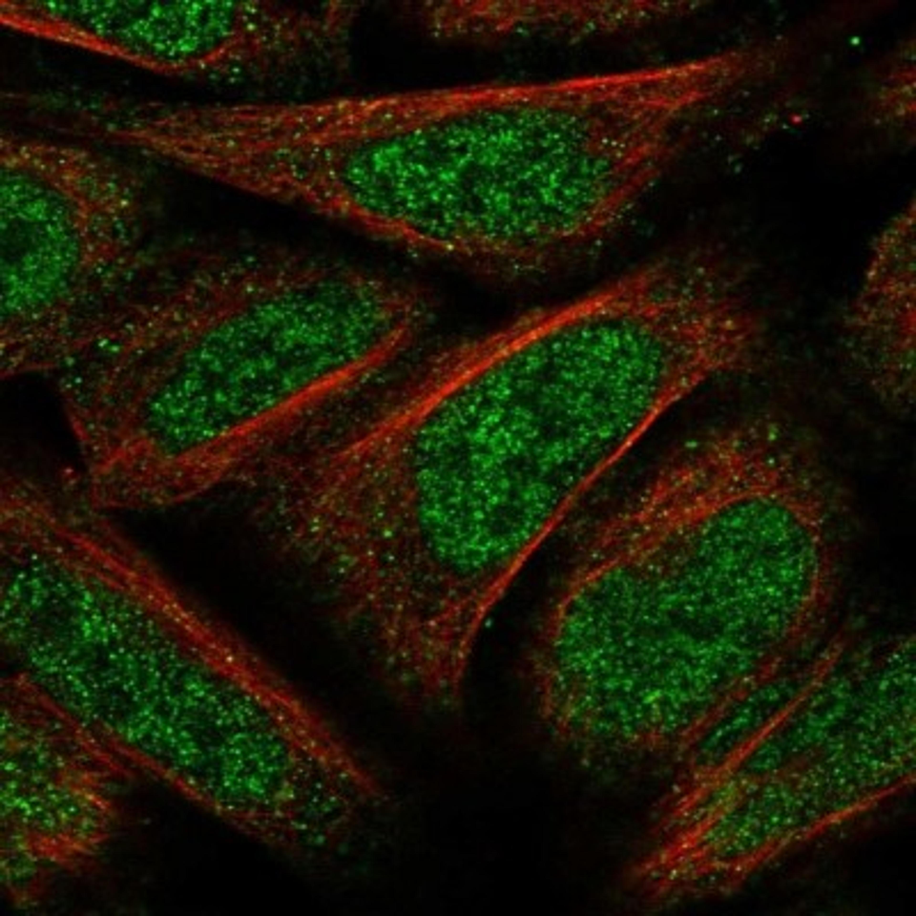 Immunocytochemistry/Immunofluorescence: C19orf66 Antibody [NBP1-90417] - Staining of human cell line U-2 OS shows positivity in nucleus but not nucleoli.