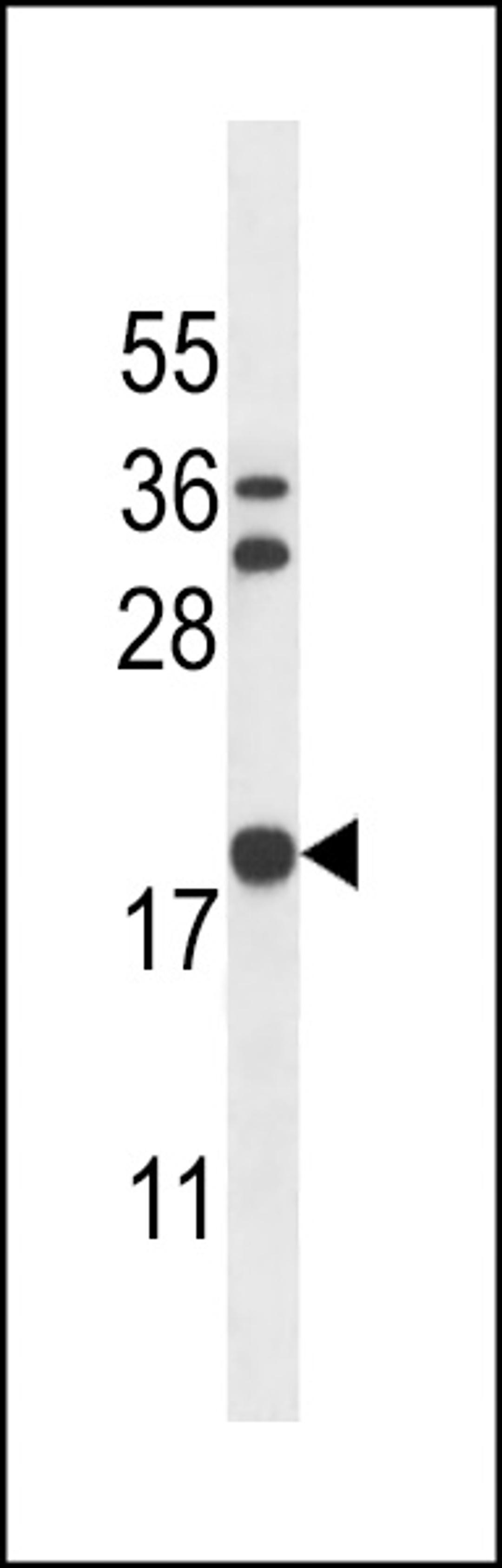 Western blot analysis in K562 cell line lysates (35ug/lane).