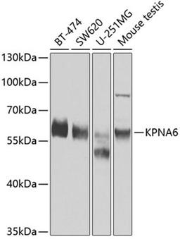 Western blot - KPNA6 antibody (A7363)