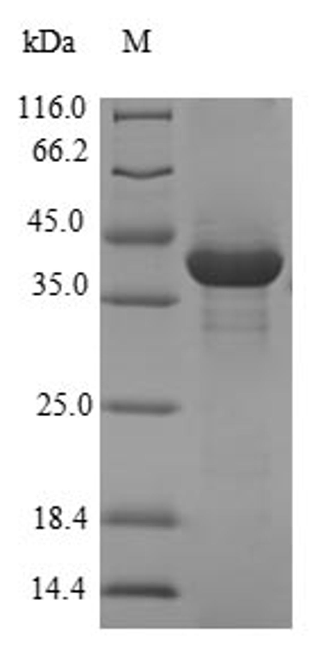 (Tris-Glycine gel) Discontinuous SDS-PAGE (reduced) with 5% enrichment gel and 15% separation gel.