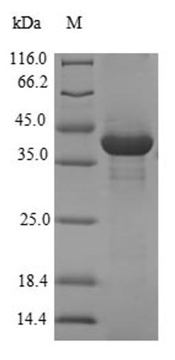 (Tris-Glycine gel) Discontinuous SDS-PAGE (reduced) with 5% enrichment gel and 15% separation gel.