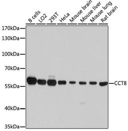 Western blot - CCT8 antibody (A4449)