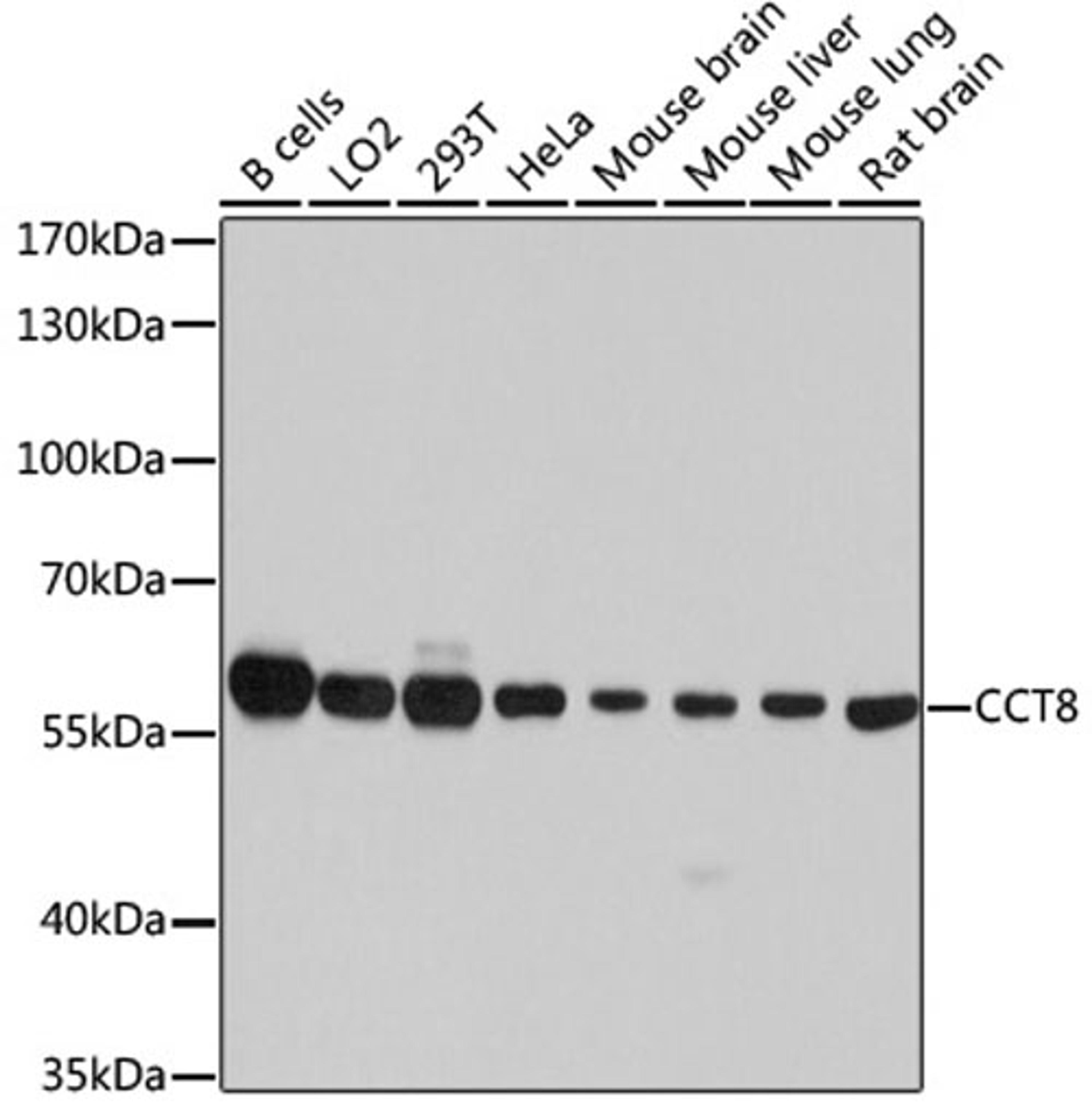 Western blot - CCT8 antibody (A4449)