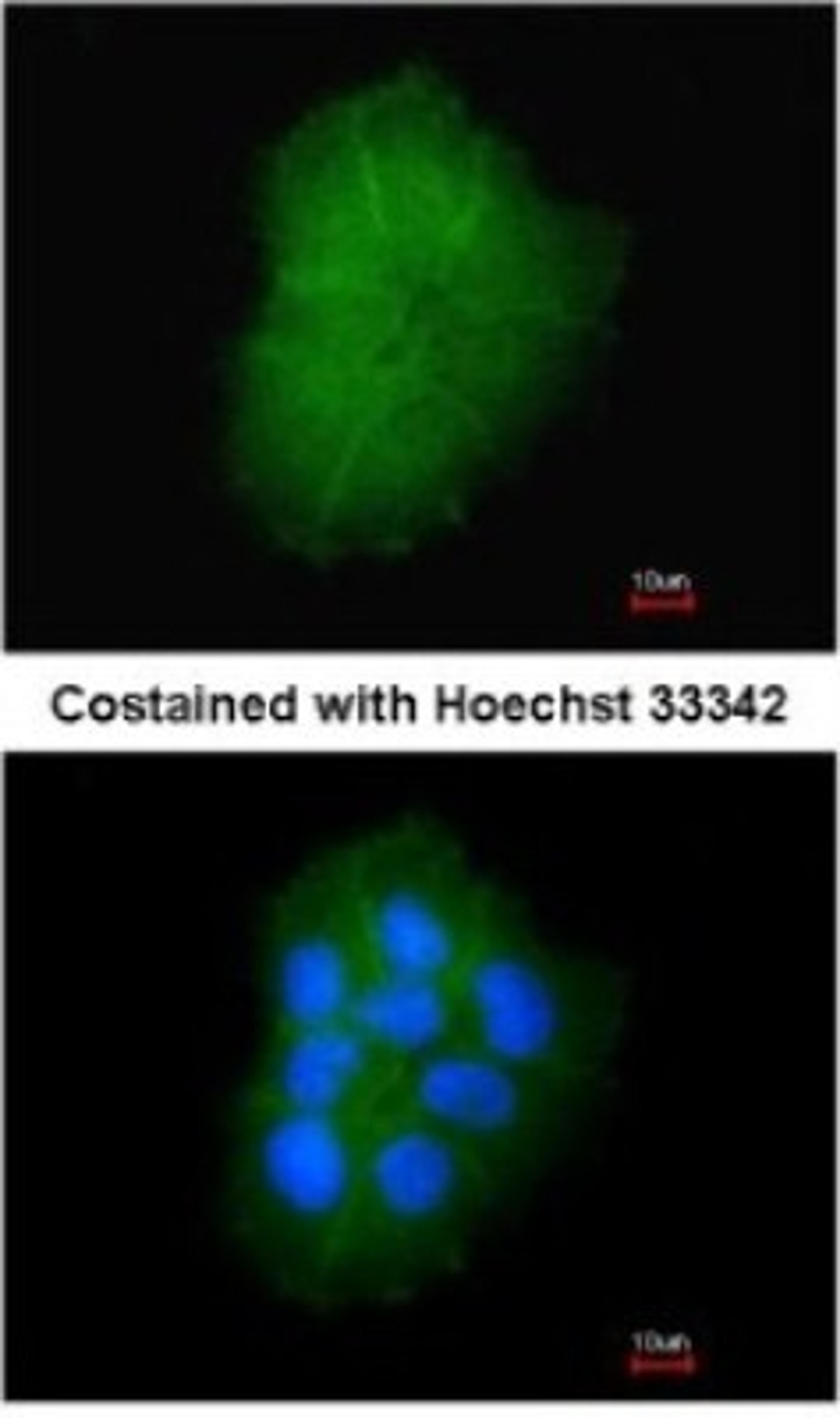 Immunocytochemistry/Immunofluorescence: TMEM147 Antibody [NBP1-32112] - Paraformaldehyde-fixed A431, using antibody at 1:200 dilution.