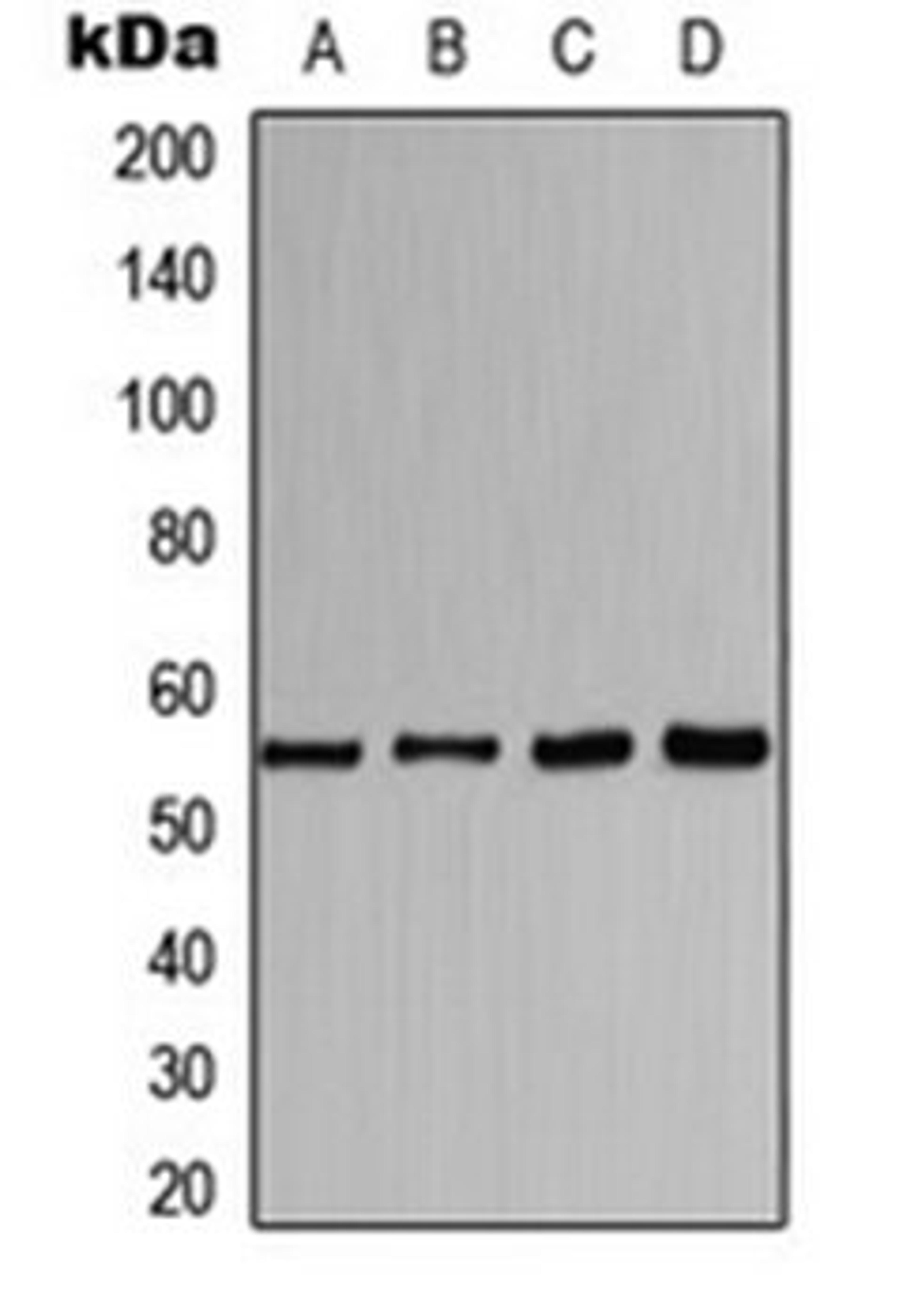 Western blot analysis of HeLa (Lane 1), MCF7 (Lane 2), mouse kidney (Lane 3), rat liver (Lane 4) whole cell lysates using CHRNA1 antibody