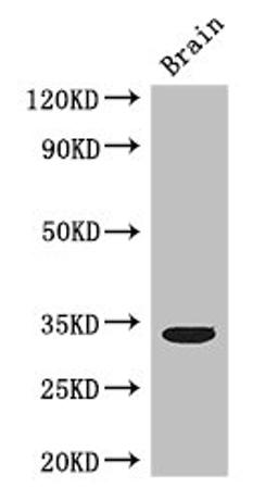 Western Blot. Positive WB detected in: Mouse brain tissue. All lanes: CCNC antibody at 3ug/ml. Secondary. Goat polyclonal to rabbit IgG at 1/50000 dilution. Predicted band size: 34, 23 kDa. Observed band size: 34 kDa.