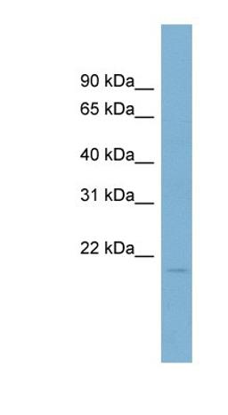 Western Blot: COTL1 Antibody [NBP1-54851] - Human Thymus lysate, concentration 0.2-1 ug/ml.