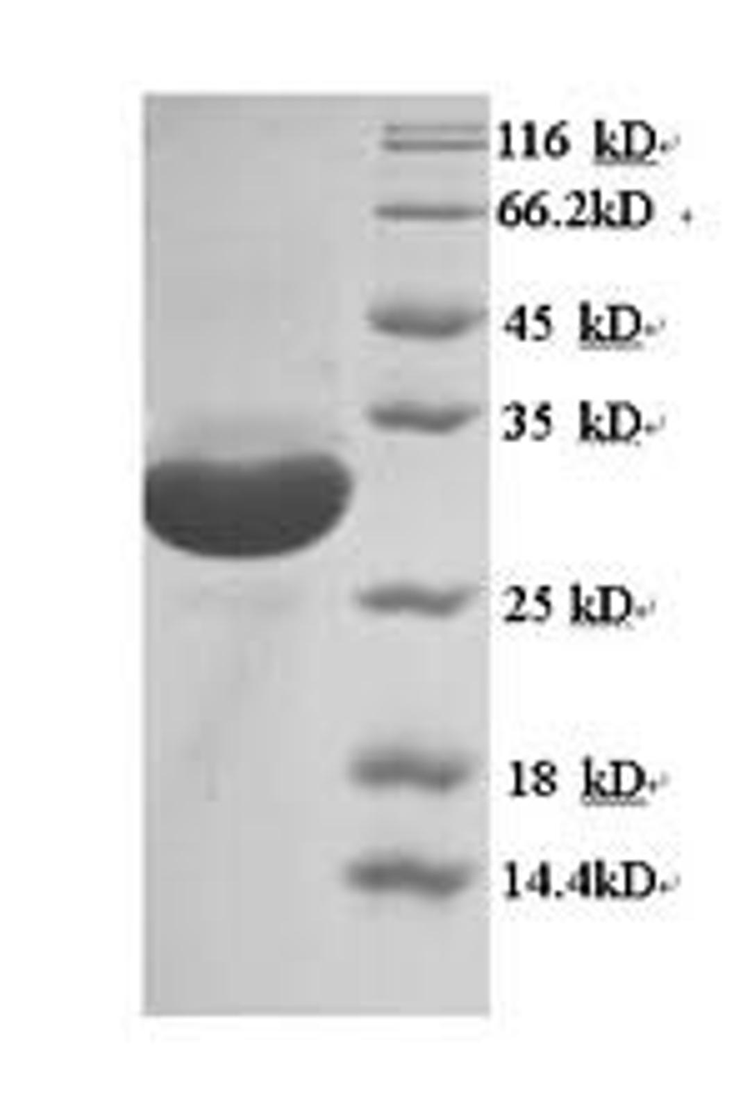 (Tris-Glycine gel) Discontinuous SDS-PAGE (reduced) with 5% enrichment gel and 15% separation gel.