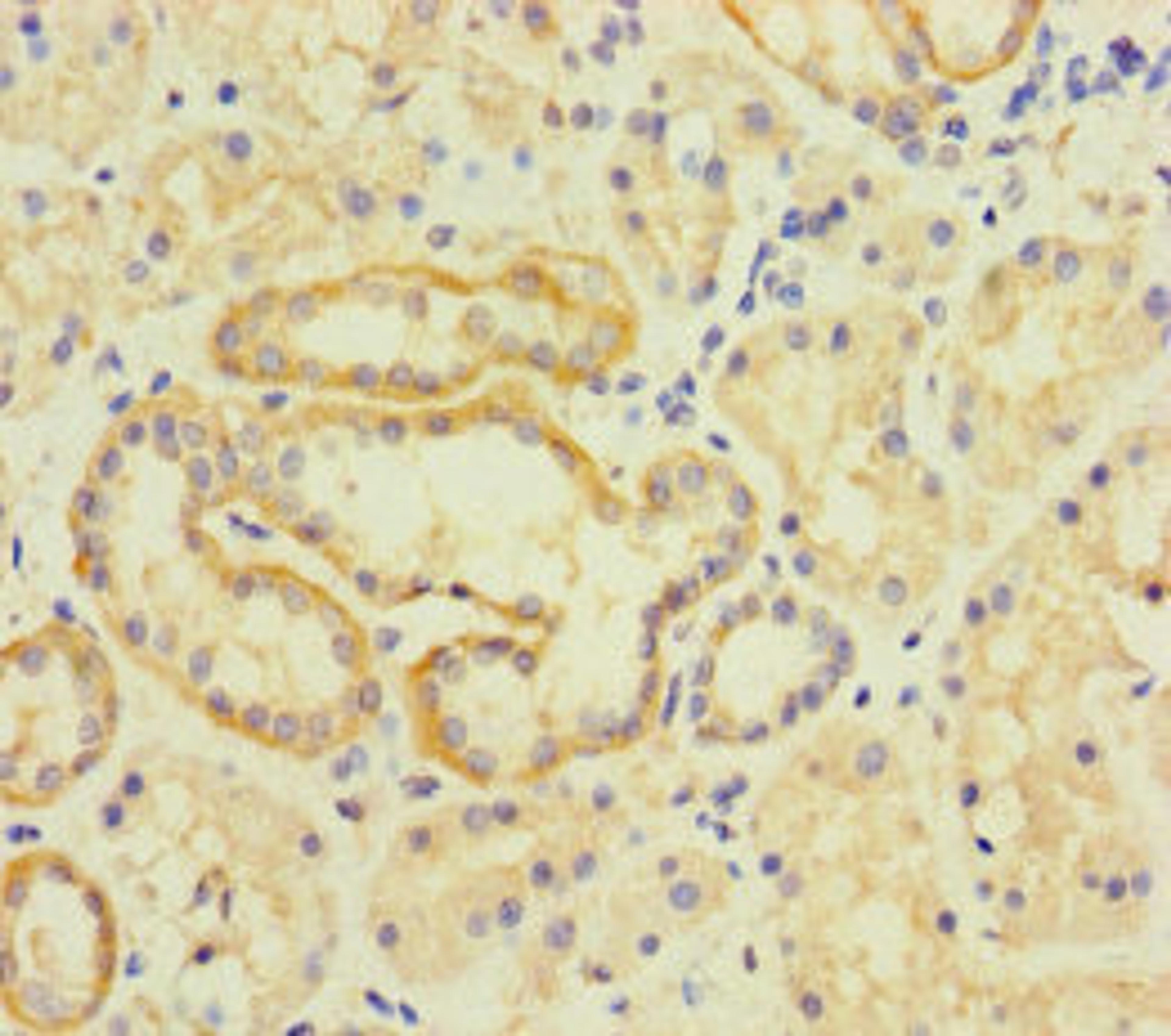 Immunohistochemistry of paraffin-embedded human kidney tissue using CSB-PA023899LA01HU at dilution of 1:100