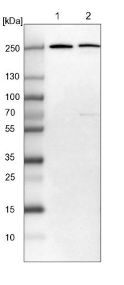 Western Blot: ASCC3L1 Antibody [NBP1-90086] - Lane 1: NIH-3T3 cell lysate (Mouse embryonic fibroblast cells)<br/>Lane 2: NBT-II cell lysate (Rat Wistar bladder tumour cells)