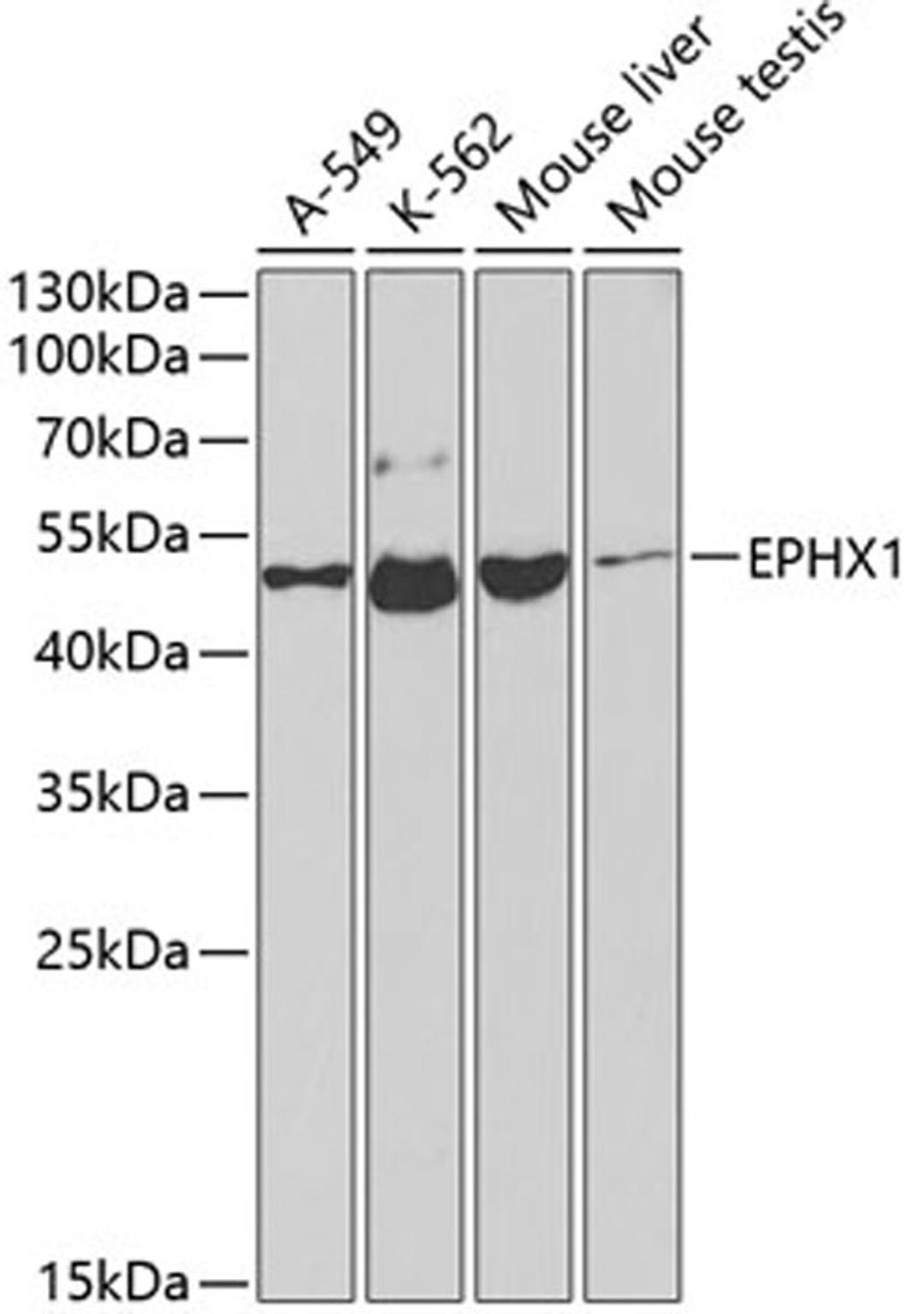 Western blot - EPHX1 antibody (A2070)