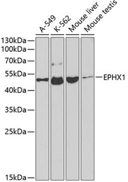 Western blot - EPHX1 antibody (A2070)