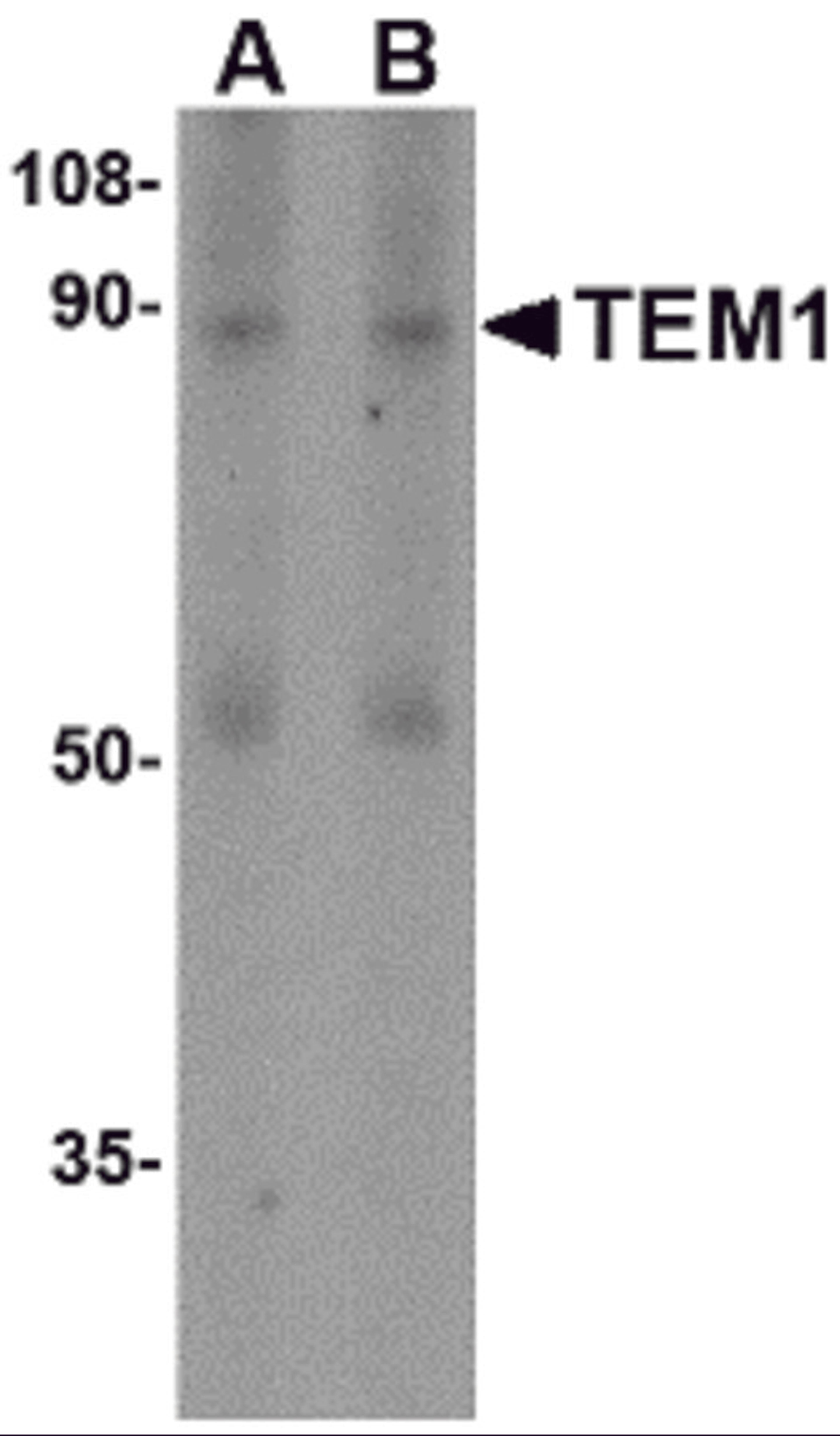 Western blot analysis of TEM1 in human colon tissue lysate with TEM1 antibody at (A) 0.5 and (B) 1 &#956;g/mL.