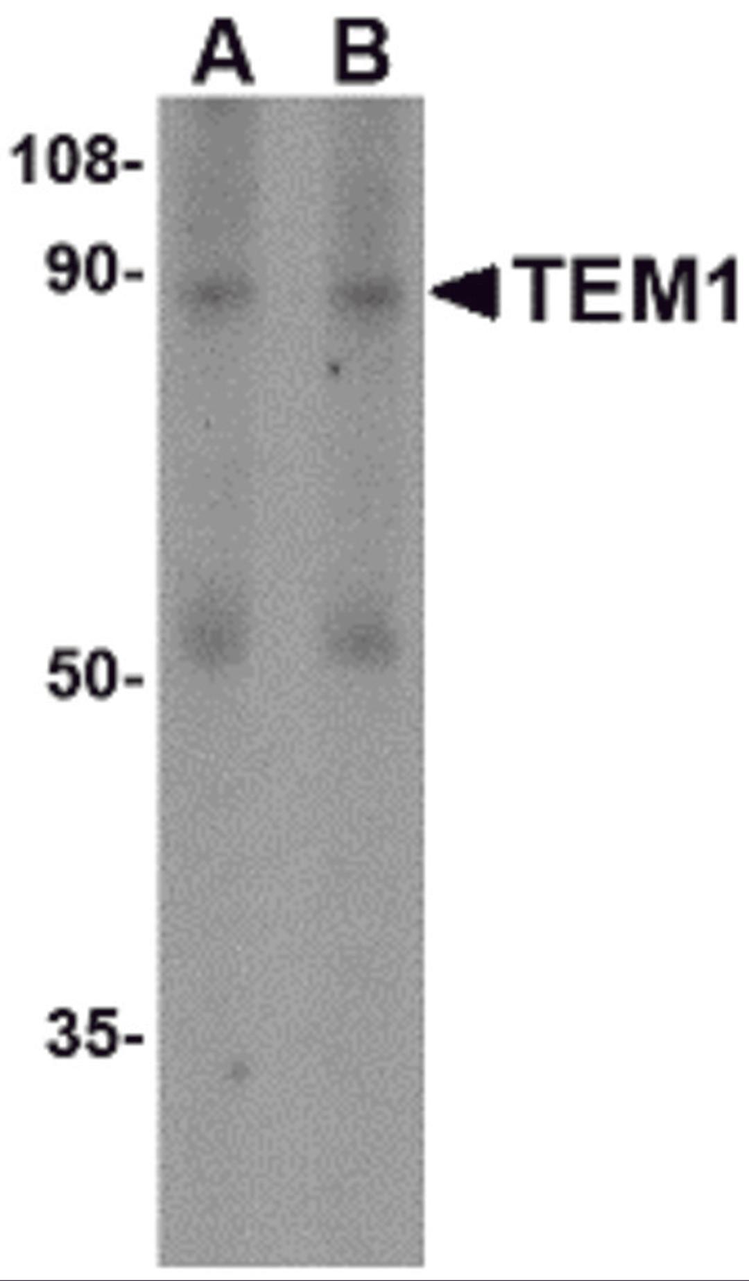 Western blot analysis of TEM1 in human colon tissue lysate with TEM1 antibody at (A) 0.5 and (B) 1 μg/mL.