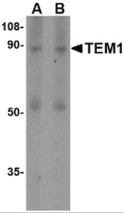 Western blot analysis of TEM1 in human colon tissue lysate with TEM1 antibody at (A) 0.5 and (B) 1 μg/mL.
