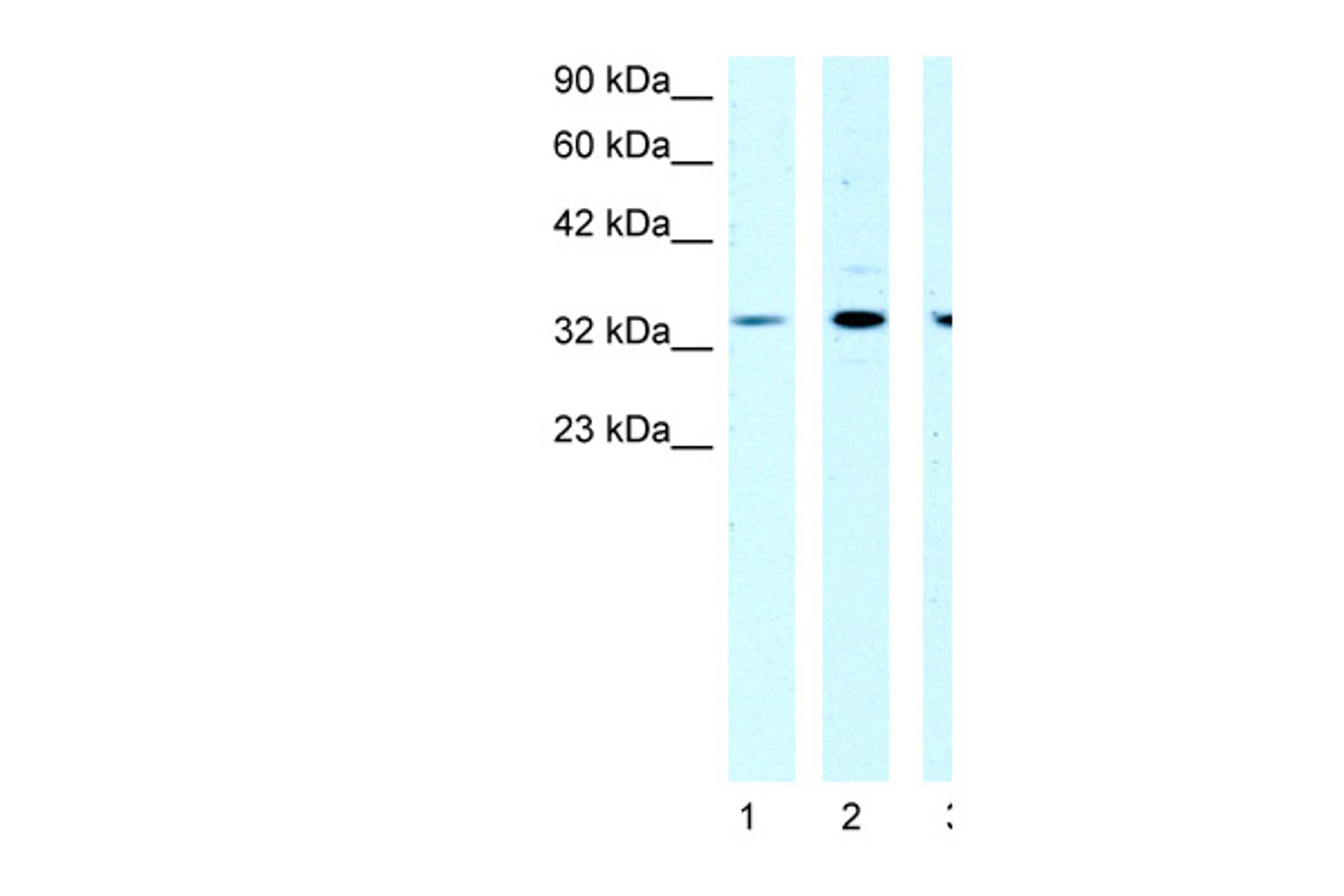 Antibody used in WB on Human HepG2 at 1 ug/ml.