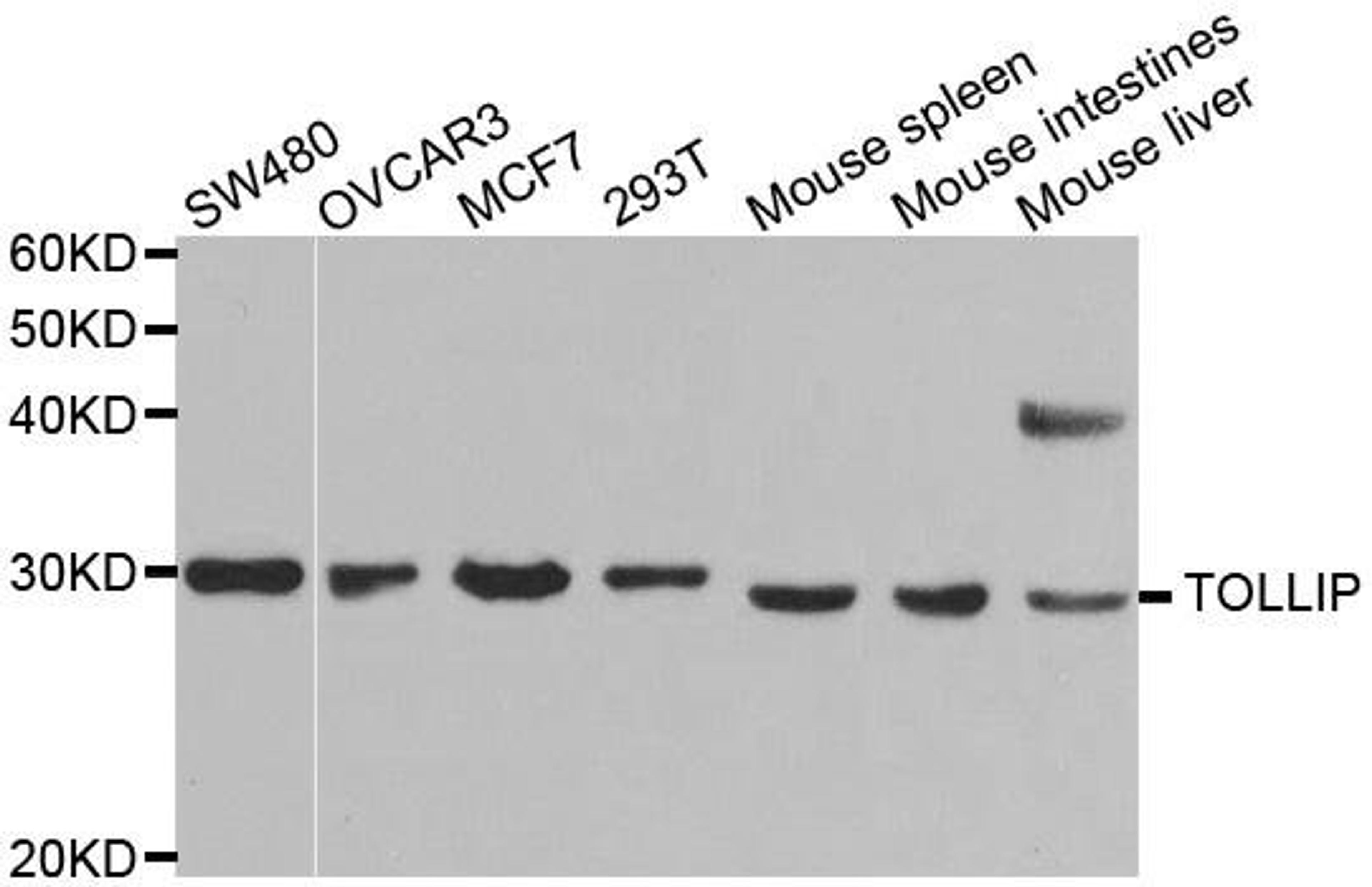 Western blot analysis of extracts of various cell lines using TOLLIP antibody