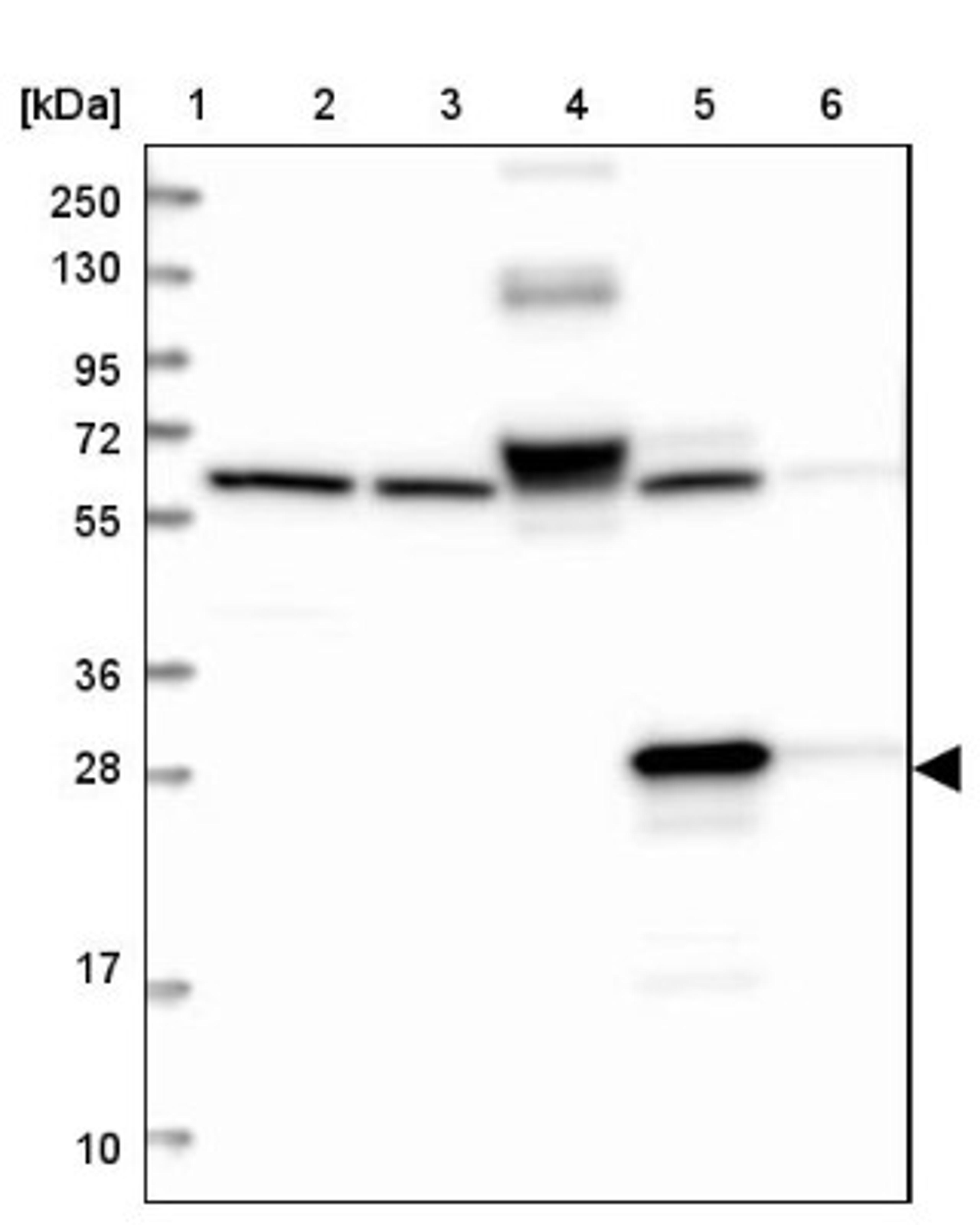 Western Blot: ECHDC3 Antibody [NBP1-82159] - Lane 1: Marker [kDa] 250, 130, 95, 72, 55, 36, 28, 17, 10<br/>Lane 2: Human cell line RT-4<br/>Lane 3: Human cell line U-251MG sp<br/>Lane 4: Human plasma (IgG/HSA depleted)<br/>Lane 5: Human liver tissue<br/>Lane 6: Human tonsil tissue