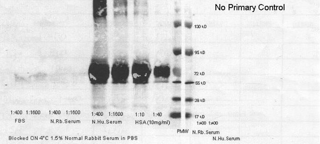 Western blot analysis of human serum albumin. 1:400 of FBS (Lane1), 1:1600 of FBS (Lane2), 1:400 of normal rabbit serum (Lane3), 1:1600 of normal rabbit serum (Lane4), 1:400 of normal human serum (Lane5), 1:1600 of normal human serum (Lane6), 1:10 of huma