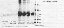 Western blot analysis of human serum albumin. 1:400 of FBS (Lane1), 1:1600 of FBS (Lane2), 1:400 of normal rabbit serum (Lane3), 1:1600 of normal rabbit serum (Lane4), 1:400 of normal human serum (Lane5), 1:1600 of normal human serum (Lane6), 1:10 of huma