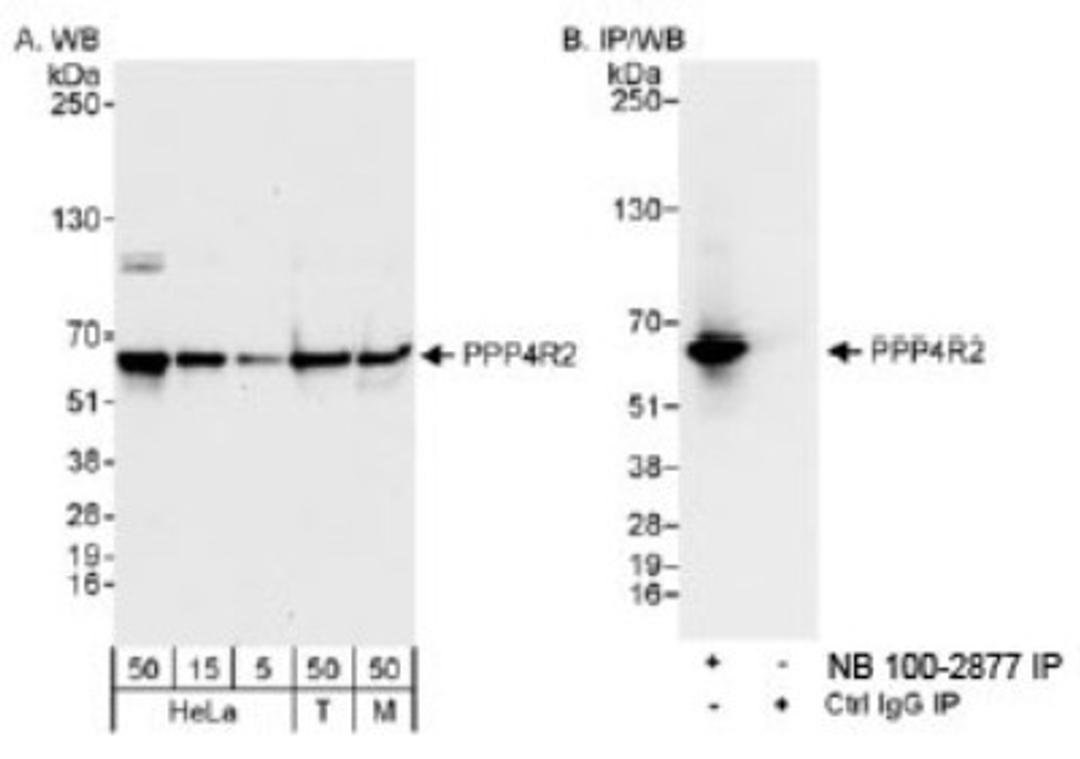 Western Blot: PPP4R2 Antibody [NB100-2877] - Detection of Human and Mouse PPP4R2 on HeLa whole cell lysate using NB100-2877.