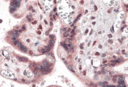 Immunohistochemistry of IRF2BP2 in human placenta with IRF2BP2 antibody at 5 μg/mL.