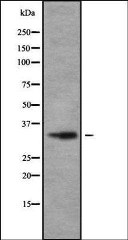 Western blot analysis of ZR-75-1 cell line lysate using OR2V1 antibody