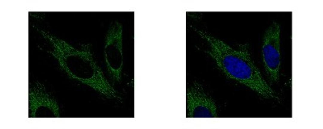 Immunocytochemistry/Immunofluorescence: Aconitase 2 Antibody [NBP2-15245] - Sample: HeLa cells were fixed in 2% paraformaldehyde/culture medium at 37C for 30 min. Green: ACO2 protein stained by Aconitase 2 antibody diluted at 1:500. Blue: Hoechst 33342 staining.