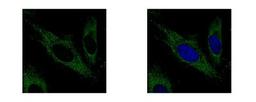 Immunocytochemistry/Immunofluorescence: Aconitase 2 Antibody [NBP2-15245] - Sample: HeLa cells were fixed in 2% paraformaldehyde/culture medium at 37C for 30 min. Green: ACO2 protein stained by Aconitase 2 antibody diluted at 1:500. Blue: Hoechst 33342 staining.