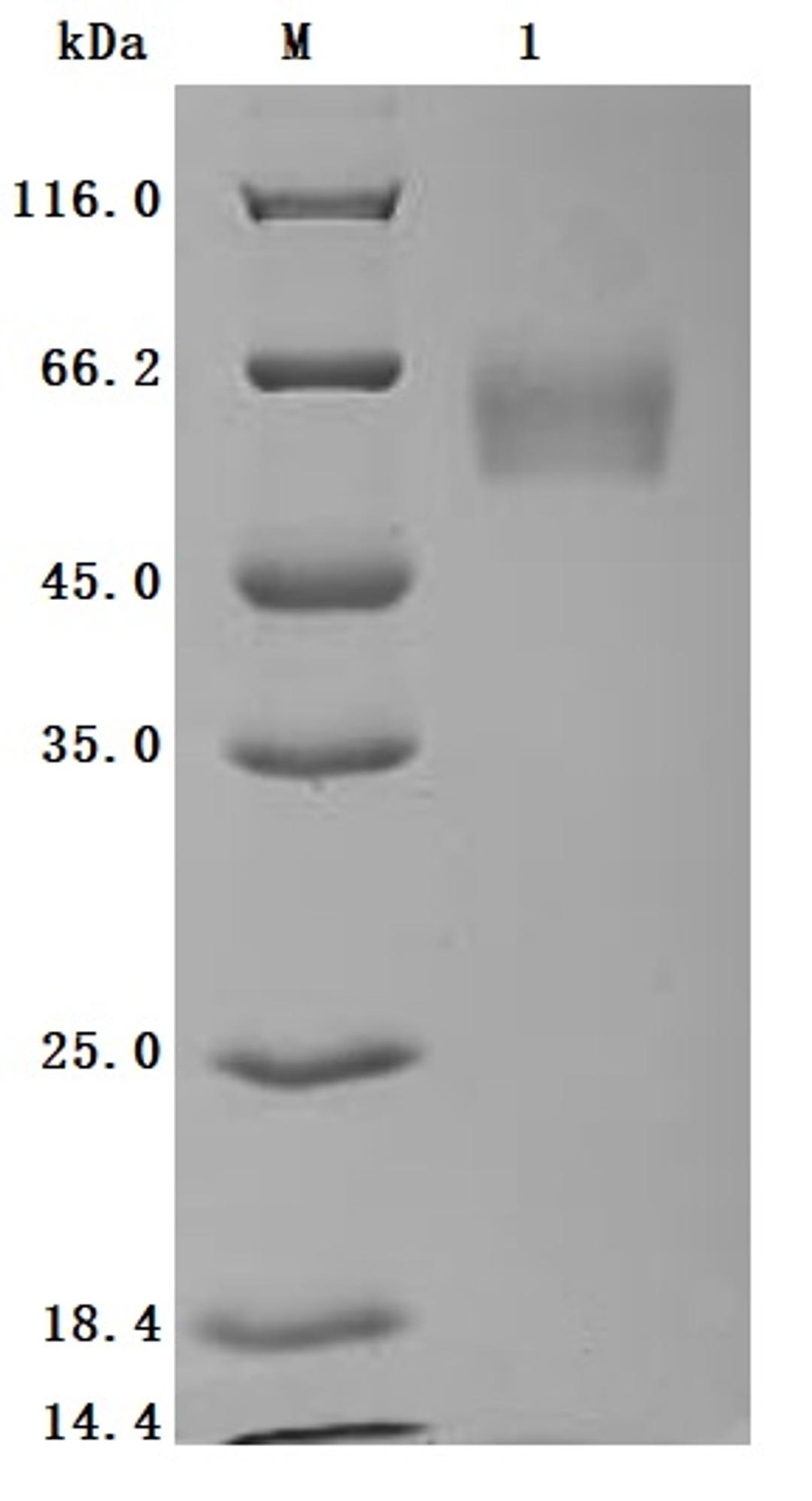 (Tris-Glycine gel) Discontinuous SDS-PAGE (reduced) with 5% enrichment gel and 15% separation gel.