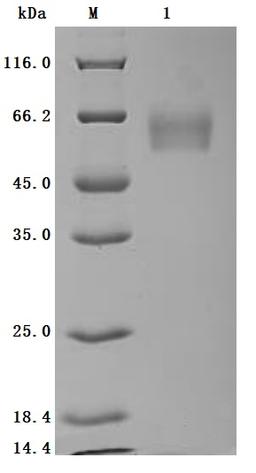(Tris-Glycine gel) Discontinuous SDS-PAGE (reduced) with 5% enrichment gel and 15% separation gel.