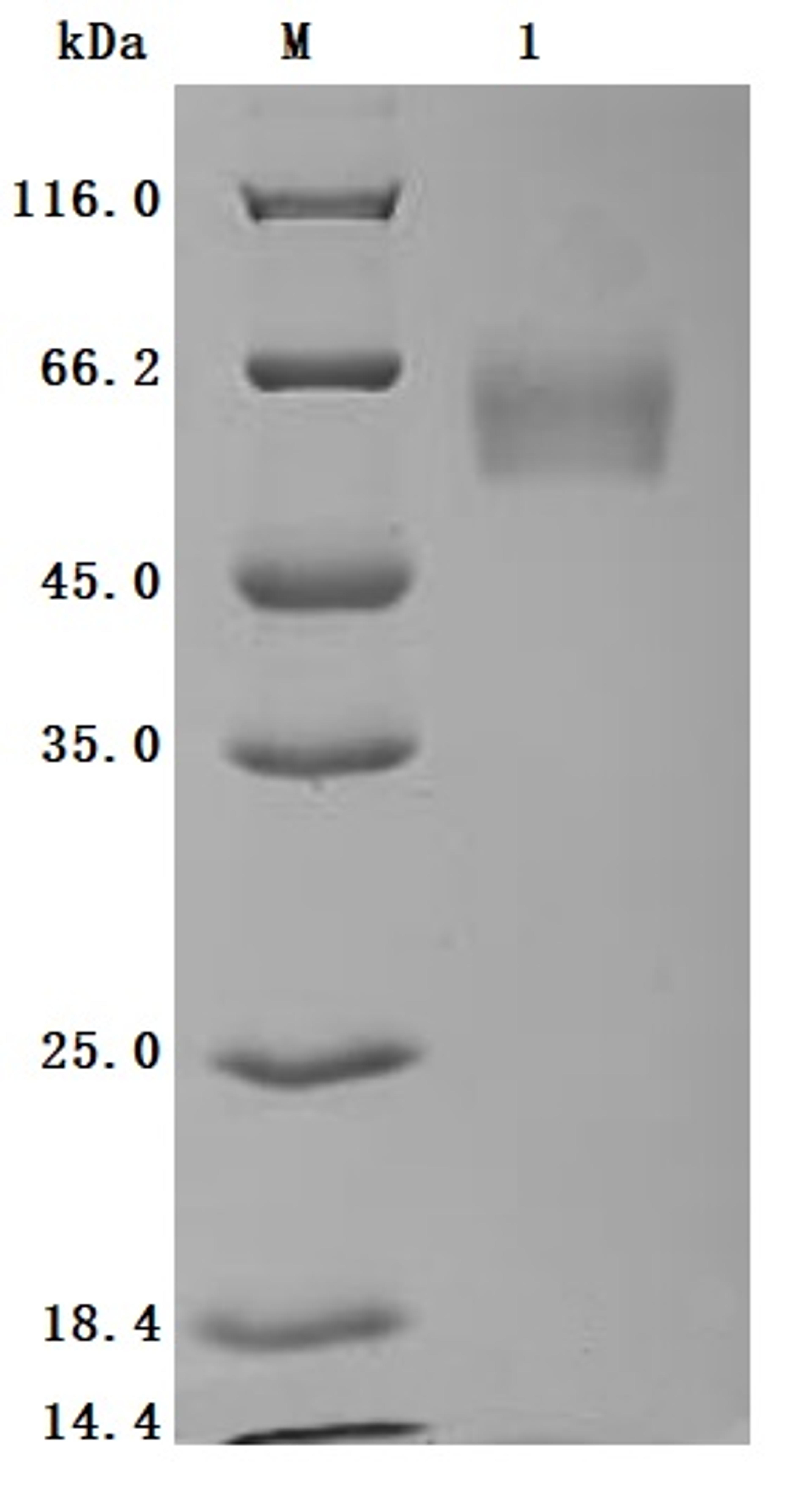 (Tris-Glycine gel) Discontinuous SDS-PAGE (reduced) with 5% enrichment gel and 15% separation gel.