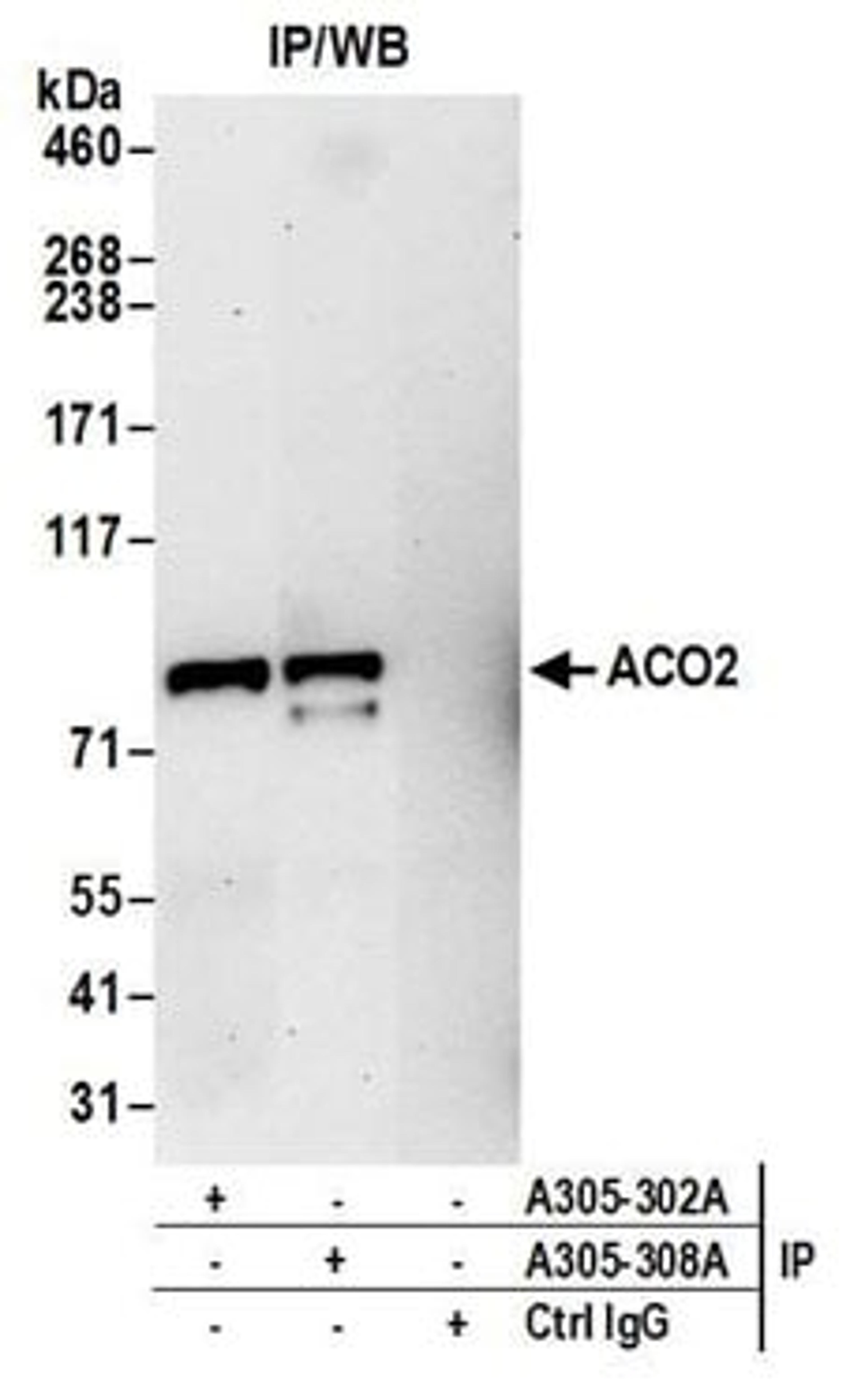 Detection of human ACO2 by western blot of immunoprecipitates.