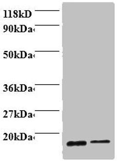 Western blot. All lanes: Profilin-1 antibody at 2ug/ml. Lane 1: EC109 whole cell lysate. Lane 2: 293T whole cell lysate. Secondary. Goat polyclonal to rabbit IgG at 1/15000 dilution. Predicted band size: 16 kDa. Observed band size: 16 kDa.