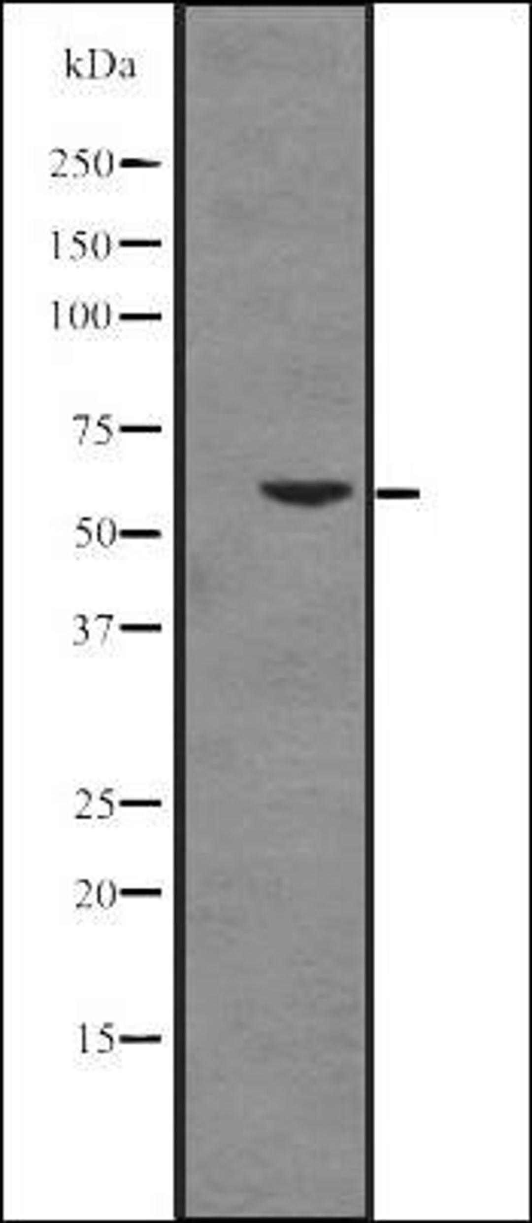 Western blot analysis of K562 cell line lysates using Cytochrome P450 17A1 antibody