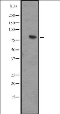 Western blot analysis of IMR32 whole cell lysate using IL17RD antibody