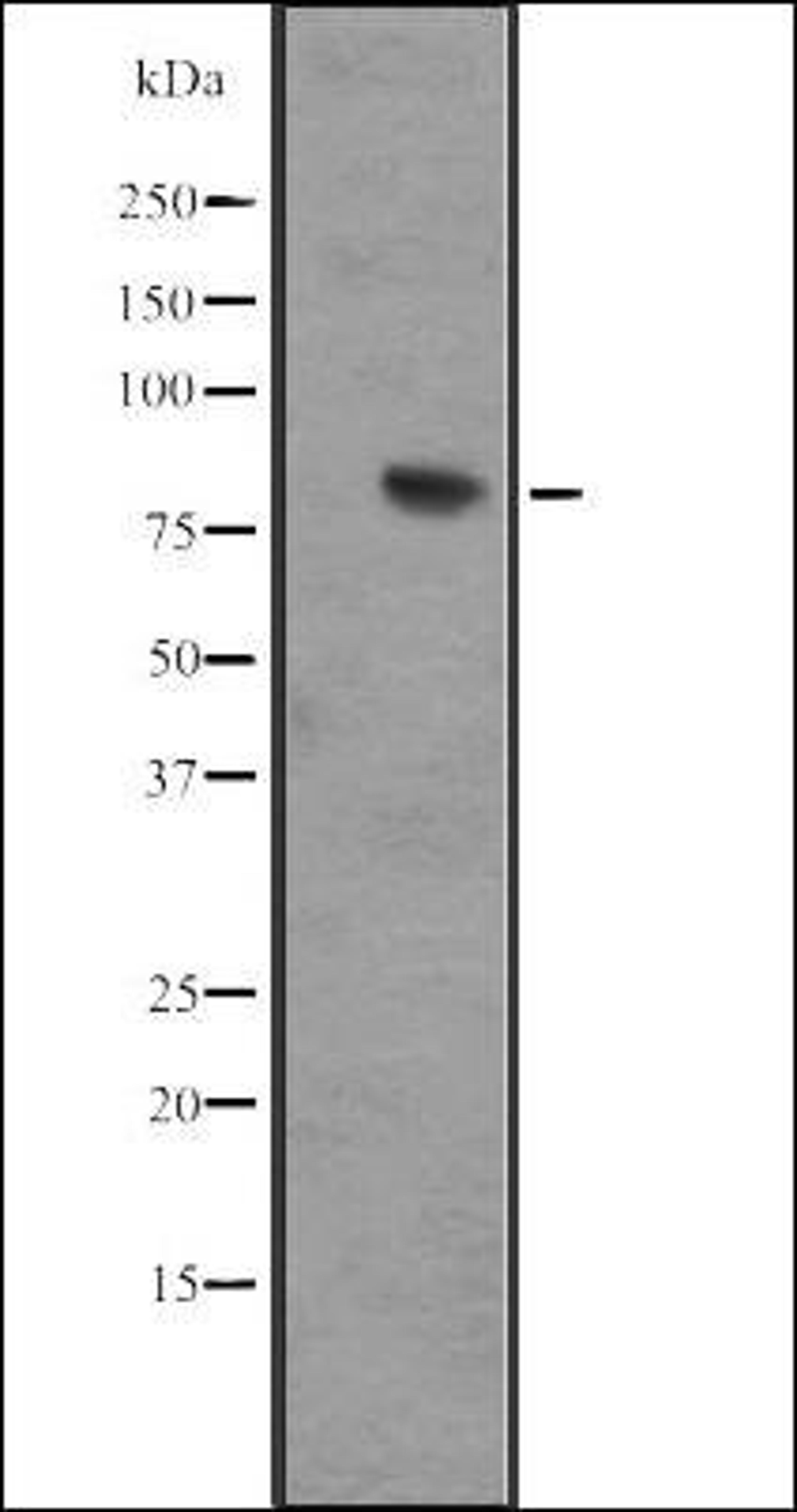 Western blot analysis of IMR32 whole cell lysate using IL17RD antibody