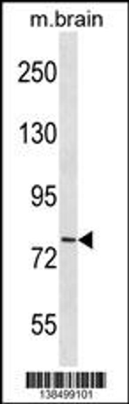 Western blot analysis in mouse brain tissue lysates (35ug/lane).