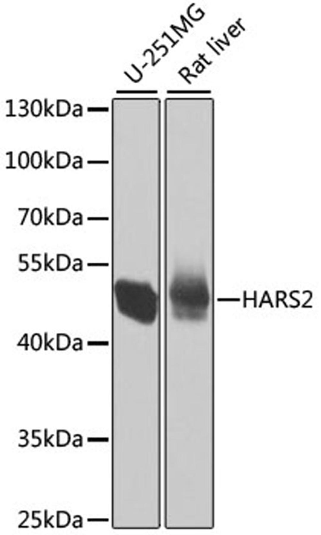 Western blot - HARS2 antibody (A7785)