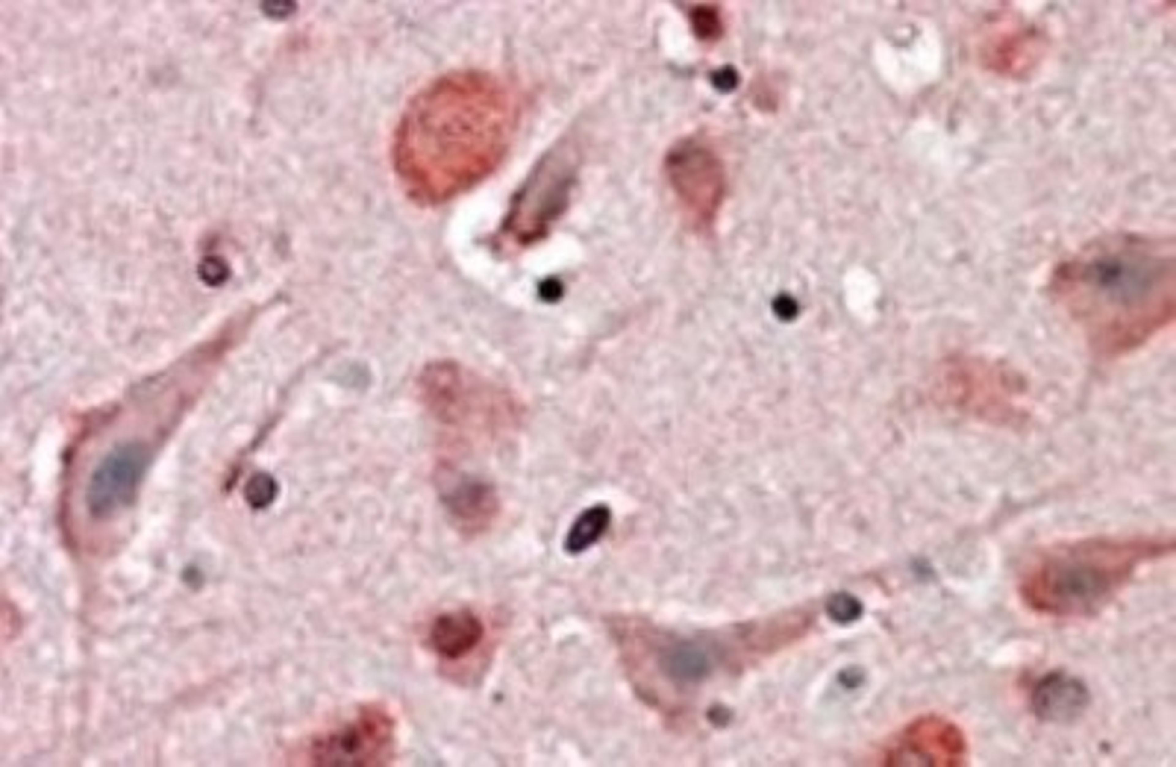 Immunohistochemistry-Paraffin: HIP2 Antibody [NB300-840] - (3.8ug/ml) staining of paraffin embedded Human Cortex. Steamed antigen retrieval with citrate buffer pH 6,