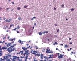 Immunohistochemistry staining of KAL1 in cerebellum tissue using KAL1 Antibody.