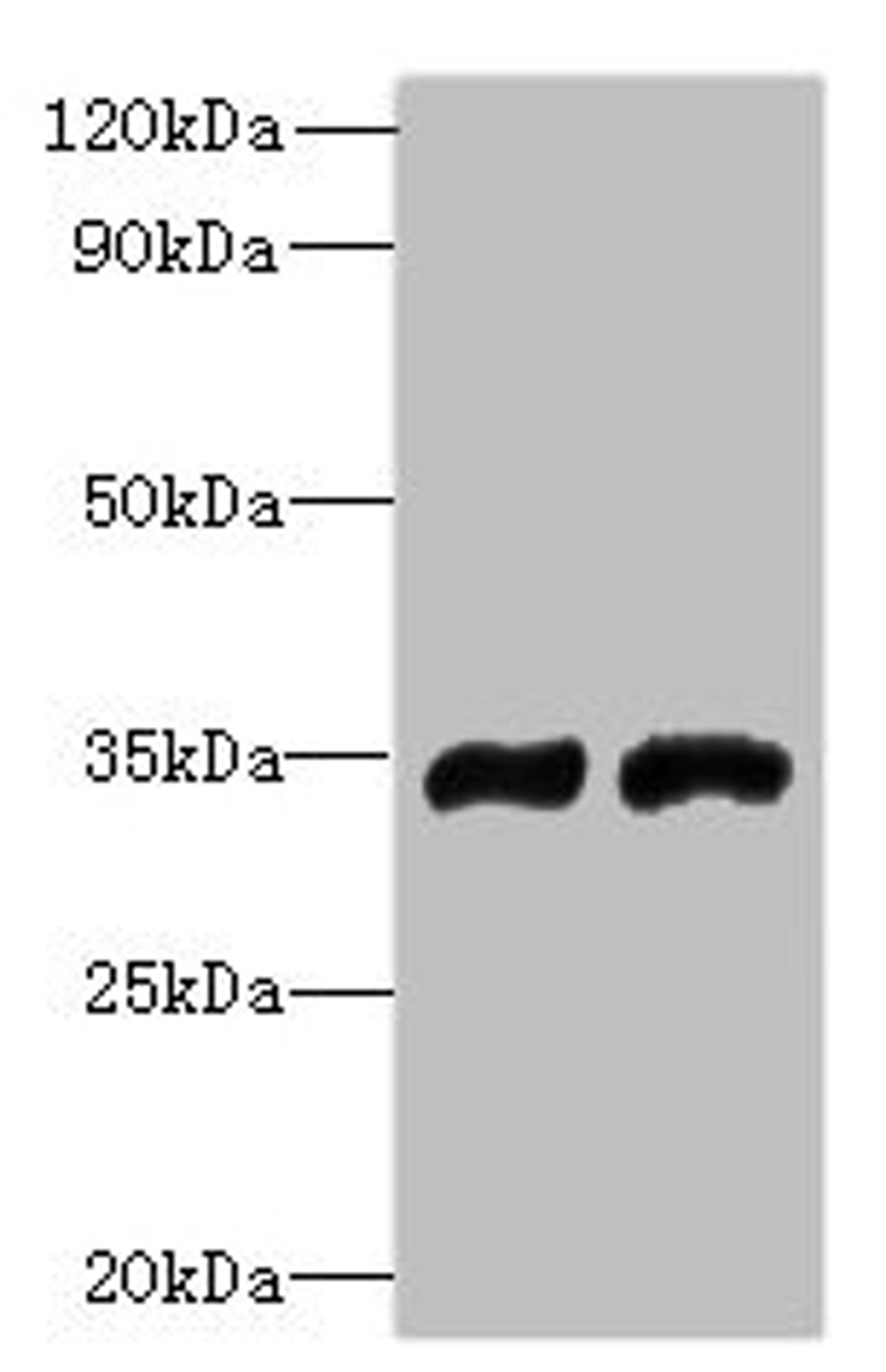 Western blot. All lanes: FYTTD1 antibody at 4µg/ml. Lane 1: A375 whole cell lysate. Lane 2: Jurkat whole cell lysate. Secondary. Goat polyclonal to rabbit IgG at 1/10000 dilution. Predicted band size: 36, 34, 29, 15 kDa. Observed band size: 36 kDa
