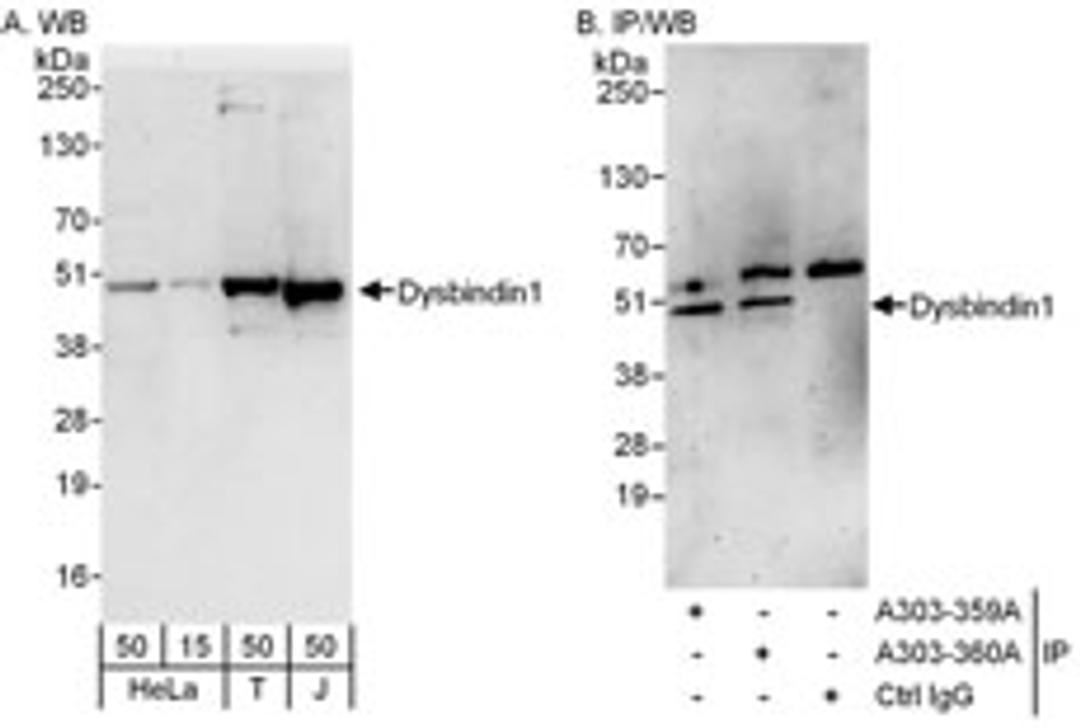 Detection of human Dysbindin1 by western blot and immunoprecipitation.